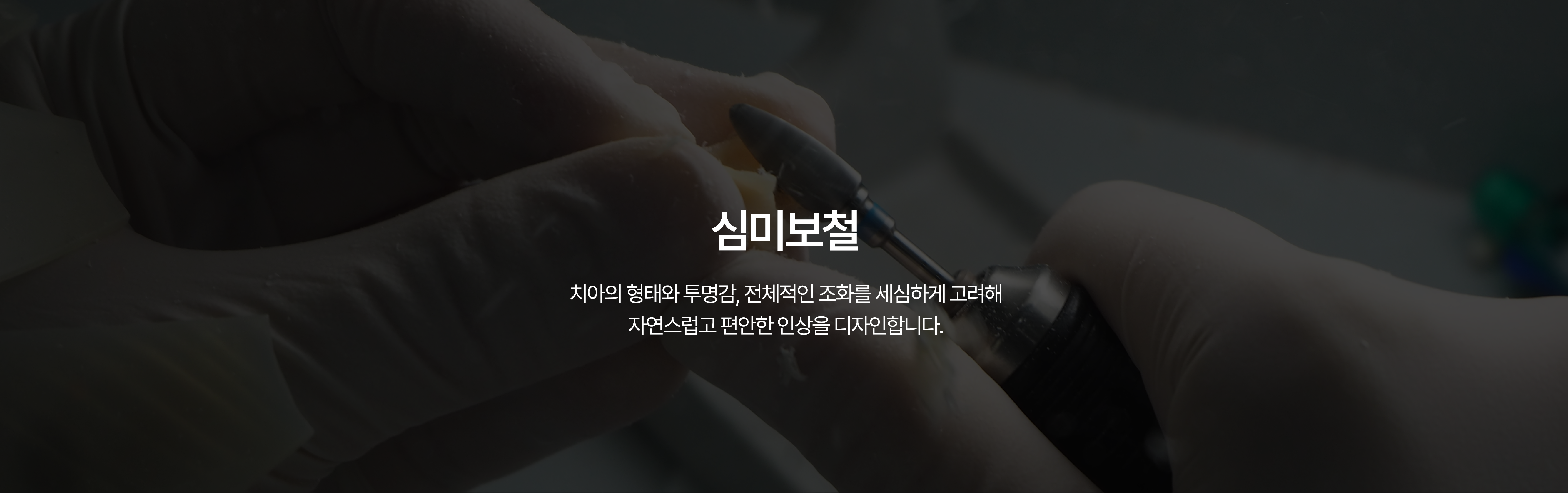 치아미백